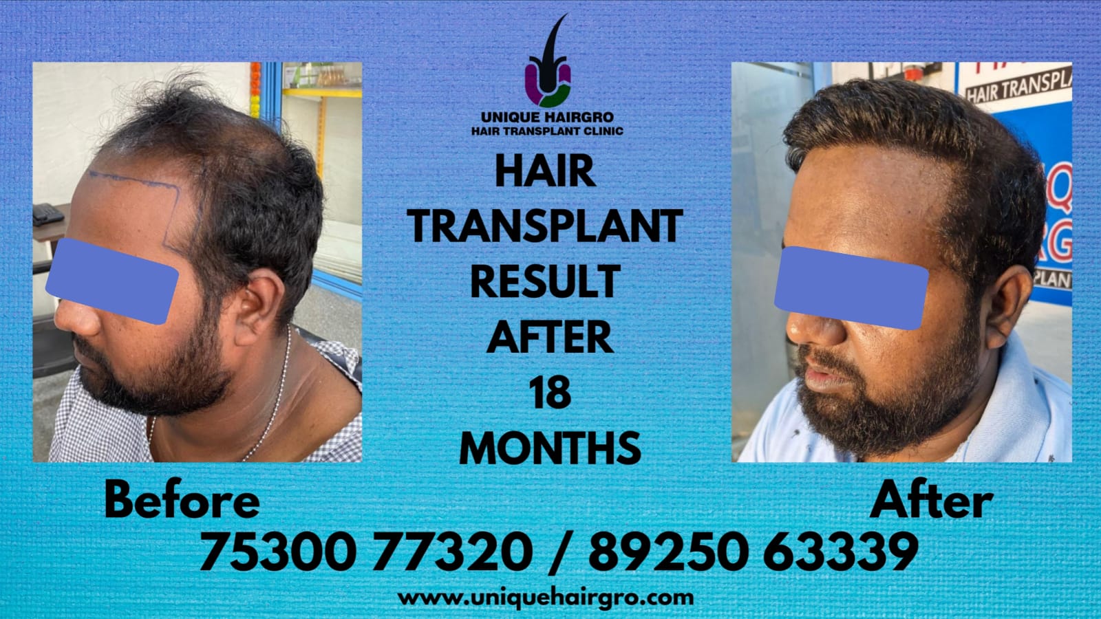 uniquehairgrow main image