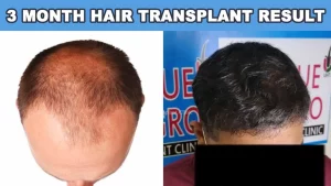 before after hair treatment