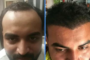 before after hair treatment